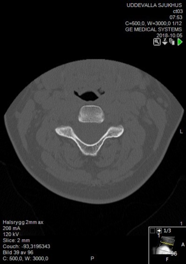 MRI-Aufnahme des Abdomens eines Patienten auf einem Computermonitor angezeigt, mit einem Smileysymbol darauf.